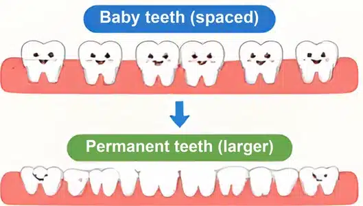 Gaps between baby teeth make room for larger adult teeth