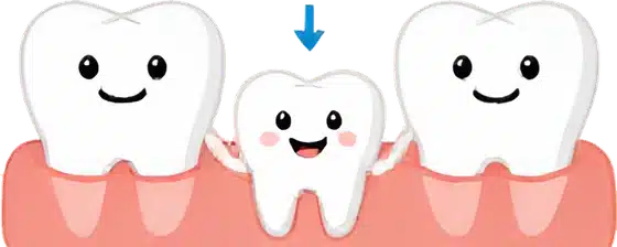 乳牙為恆牙保留位置