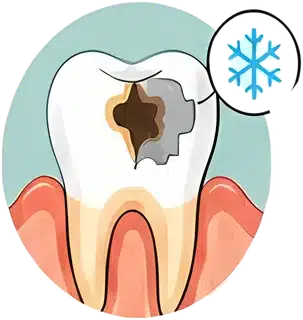 Cavity letting cold reach the nerve