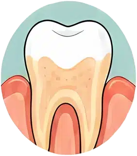 Enamel wear and acid erosion
