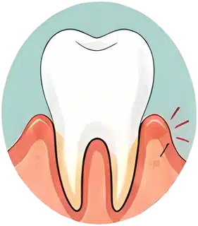 Gum recession exposing the tooth root